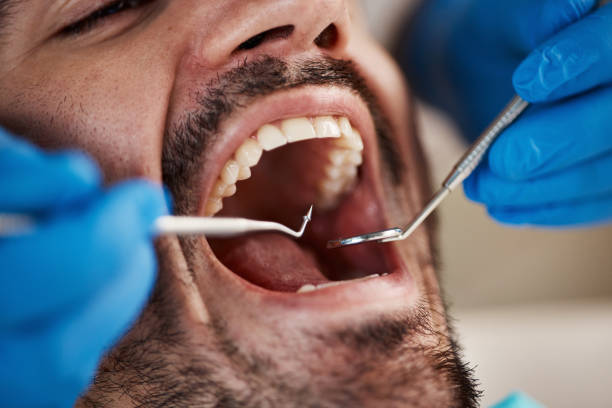 Best Urgent Tooth Repair  in Murphy, MO