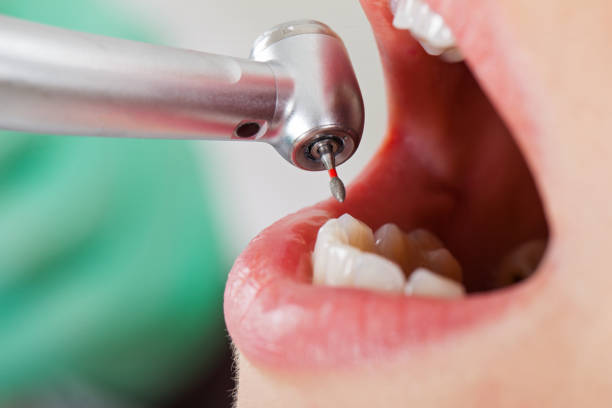 Best Knocked-Out Tooth Emergency  in Murphy, MO